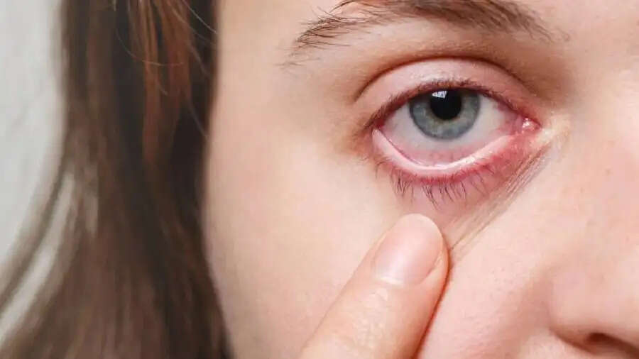Health Tips-&nbsp;फ्लू होने पर दिखाई देते हैं ये लक्षण, नजरअंदाज करना हो सकता हैं नुकसानदायक