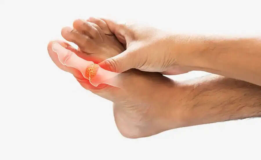 Health Tips-&nbsp;क्या आपके शरीर में बार बार बढ़ रहा है यूरिक एसिड़, आहार से दूर करें ये दाल