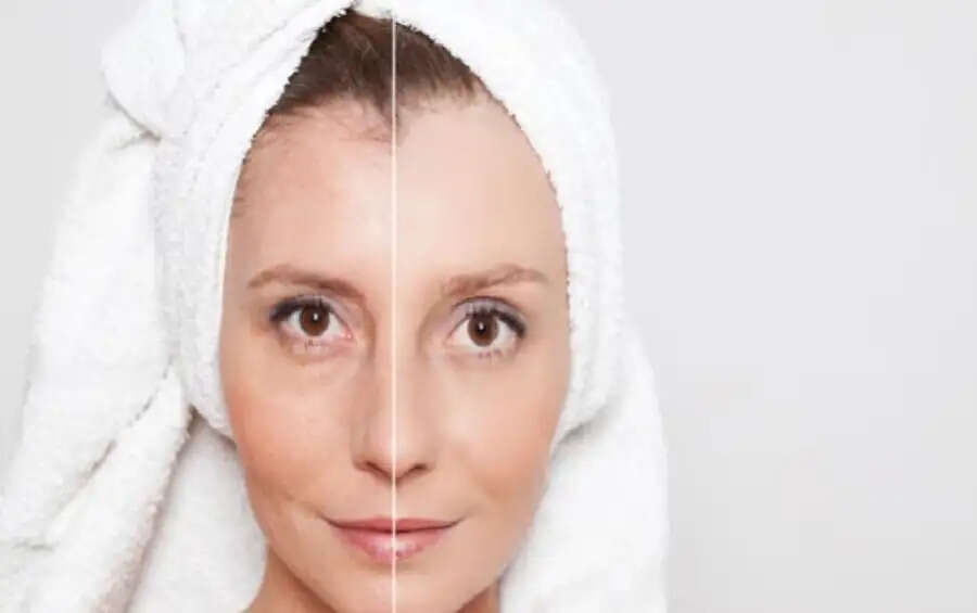 Skin Care Tips- क्या चेहरे की स्किन ढीली हो गए हैं, टाइट बनाने के लिए करें ये काम