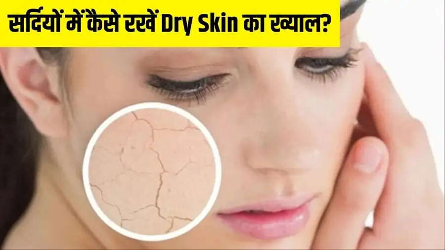 Skin Care Tips-&nbsp;क्या सर्द मौसम की वजह स्किन ड्राई हो गई है, तो अपनाएं ये तरीके
