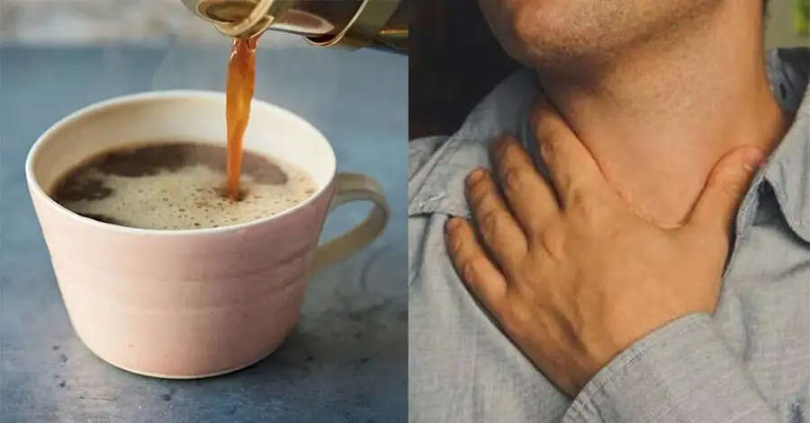 Health Tips –&nbsp; क्या आप गर्म चाय पीने के शौकिन हैं, जान लिजिए इसके नुकसान