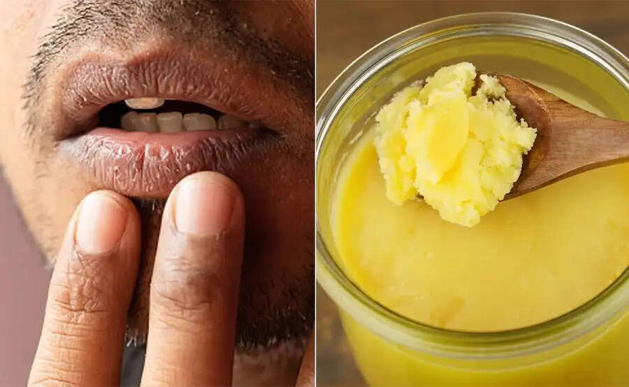 Lips Care Tips-&nbsp;क्या काले होँठ खूबसूरती में बाधा डालते हैं, ऐसे बनाए उन्हें गुलाबी
