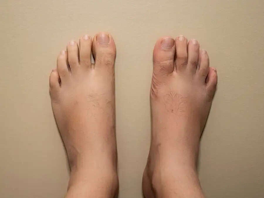 General Tips-&nbsp;क्या पैरों की गंदगी ने परेशान कर रखा हैं, साफ करने के लिए अपनाएं ये टिप्स
