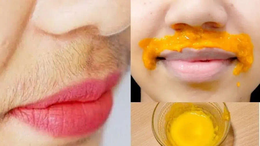 Lips Care Tips-&nbsp;क्या होठों के उपर वाले बालों ने बिगाड़ दी खूबसूरती, हटाने के लिए अपनाएं ये घरेलू उपाय