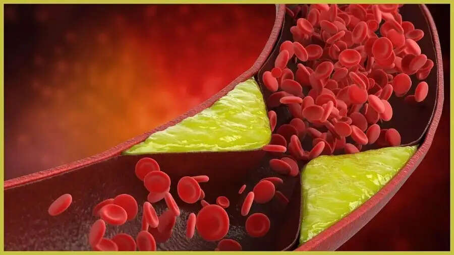 Health Tips- क्या नसों में खराब कोलेस्ट्रॉल जमा हो गया हैं, साफ करने के लिए पिएं यह पानी