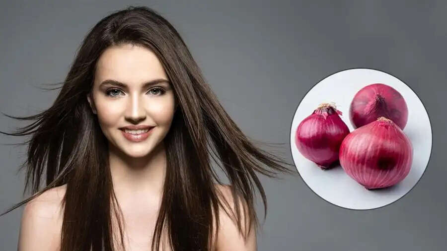 Hair Care Tips-  बालों के लिए प्याज का रस होता हैं फायदेमंद, जानिए कैसे करना हैं इस्तेमाल