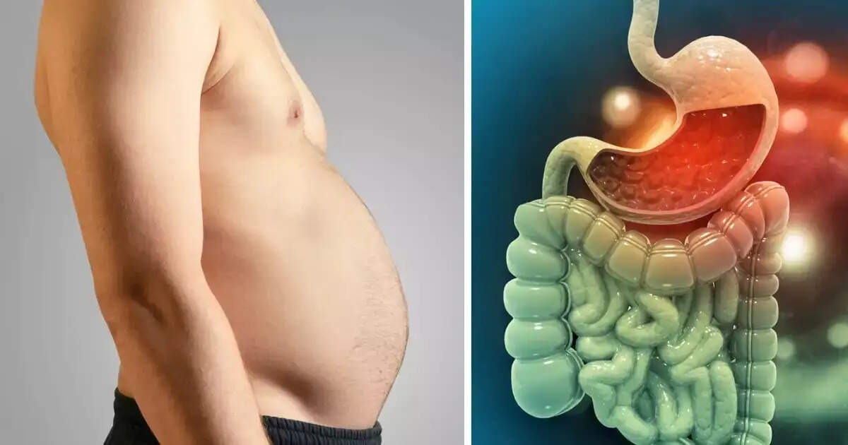 Health Tips- क्या पेट की गैस से परेशान, तो तुरंत करें ये काम, फूला हुआ पेट हो जाएगा फुस्स