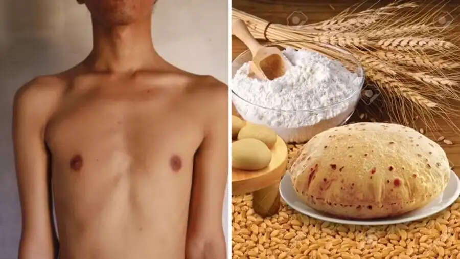 Health Tips- गेहूं की रोटी खाने से होती हैं स्वास्थ्य समस्याएं, जानिए इनके बारे में