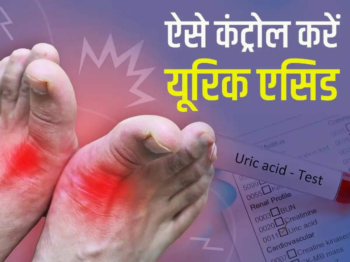 Health Tips- क्या आपके शरीर में यूरिक एसिड बढ़ गया हैं, ऐसे करें इसे कम