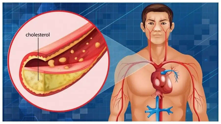 Health Tips-&nbsp;क्या शरीर में बहुत ज्यादा कोलेस्ट्रॉल बढ़ गया हैं, तो ऐसे करें कम