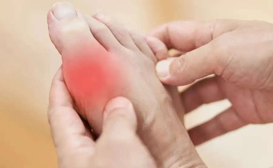 Health Tips- क्या शरीर में बढ़ गया हैं यूरिक एसिड़, तो इन ड्राई फ्रूट्स का करें सेवन
