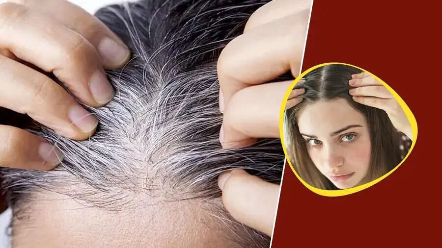 Hair Care Tips-  शरीर में इस विटामिन की कमी से सफेद हो जाते हैं बाल, जानिए इसके बारे में