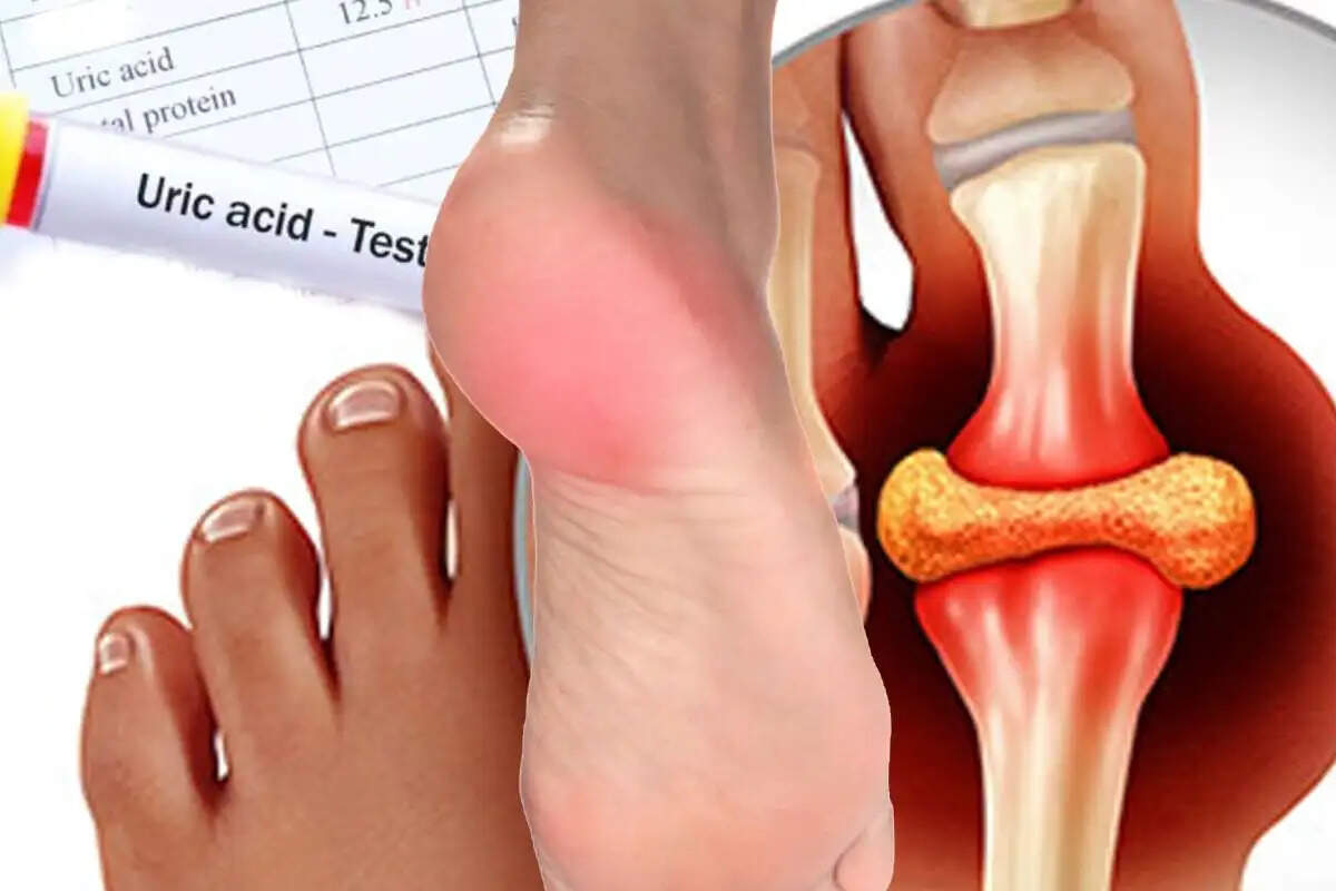 Health Tips- शरीर में बढ़ते हुए यूरिक एसिड को रोकने में मदद करेंगे ये फल, जानिए इनके बारे में