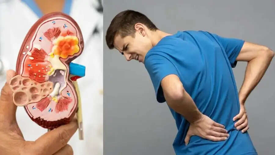 Health Tips-&nbsp;आपकी ये बुरी आदतें किडनी सेहत का बुरा हाल, जानिए पूरी डिटेल्स