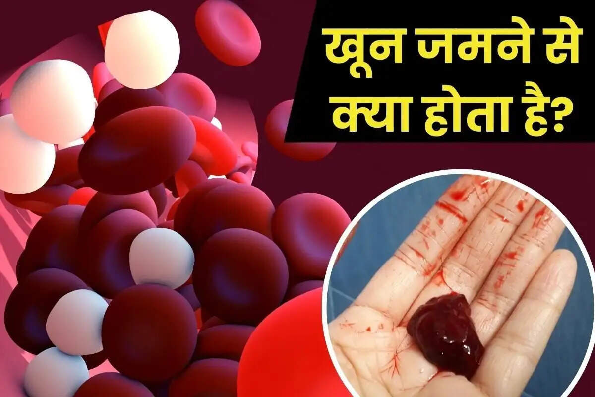 Health Tips- आपकी खराब लाइफस्टाइल बन सकती हैं ब्रेम में ब्लड क्लॉटिंग का कारण, जानिए इन गलतियों के बारे में