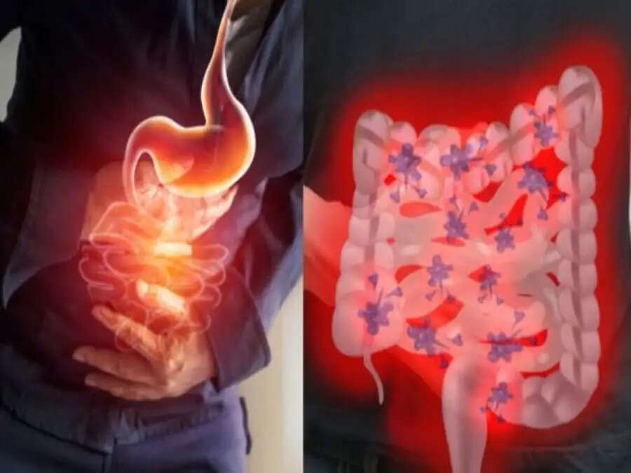 Health Tips-&nbsp;अगर आपको दिखाई दे रहे हैं ये लक्षण, तो हो गया हैं पेट इंफेक्शन