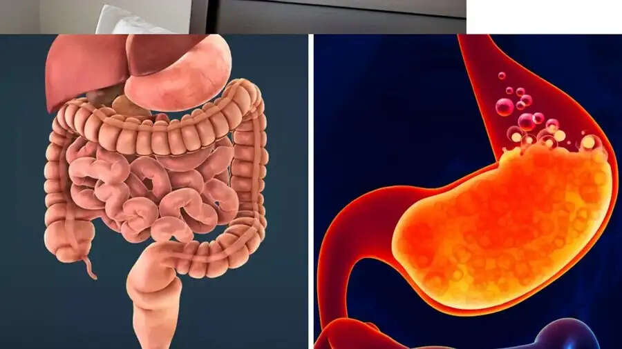 Health Tips-&nbsp;इन वजहों सेल आतों में जमा होती हैं गंदगी, जानिए इनके बारे में