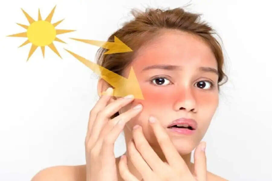Sun Tan हो जाएगा छूमंतर, बस ट्राई कर लें ये होम रेमेडीज