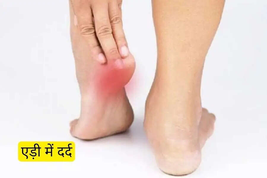 Health Tips-&nbsp;क्या आपकी एड़ियों में अक्सर दर्द रहता है, जानिए इसका कारण