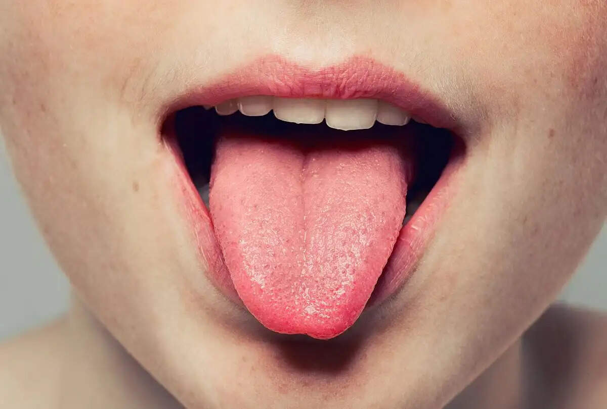 Health Tips- &nbsp;आपकी जीभ का रंग बताता हैं आपके स्वास्थ्य का हाल, जानिए कौनसा रंग क्या कहता हैं