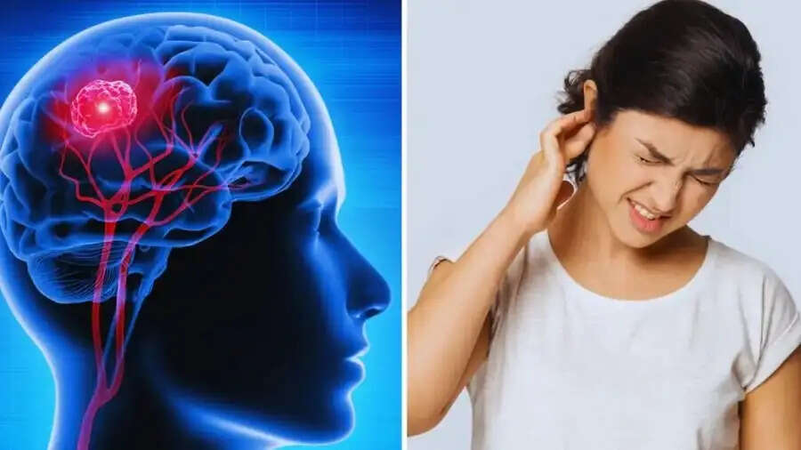 Health Tips- ब्रेन ट्यूमर के शुरुआती लक्षण कुछ ऐसे होते हैं, जिनको नजरअंदाज करना हो सकता हैं नुकसानदायक