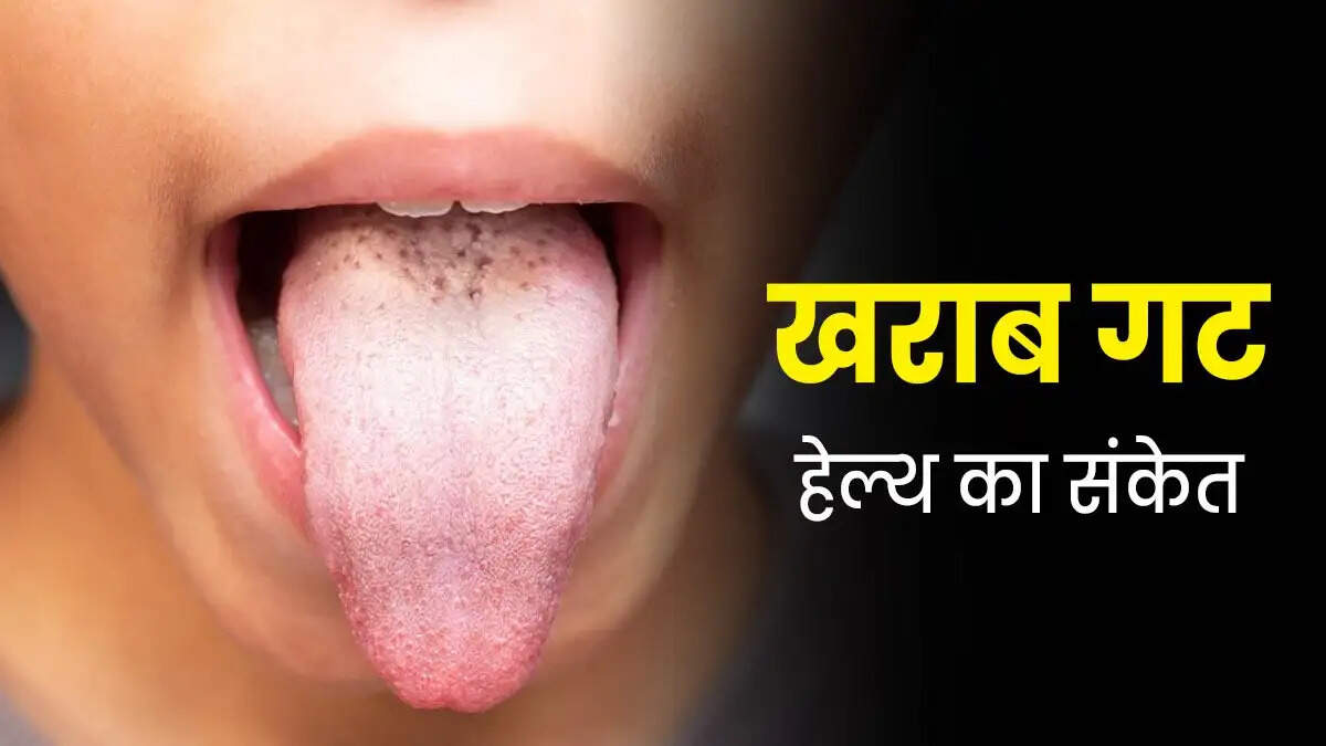 Health Tips- क्या आपकी जीभ सफेद हो रही हैं, जानिए किसी बीमारी का हैं संकेत