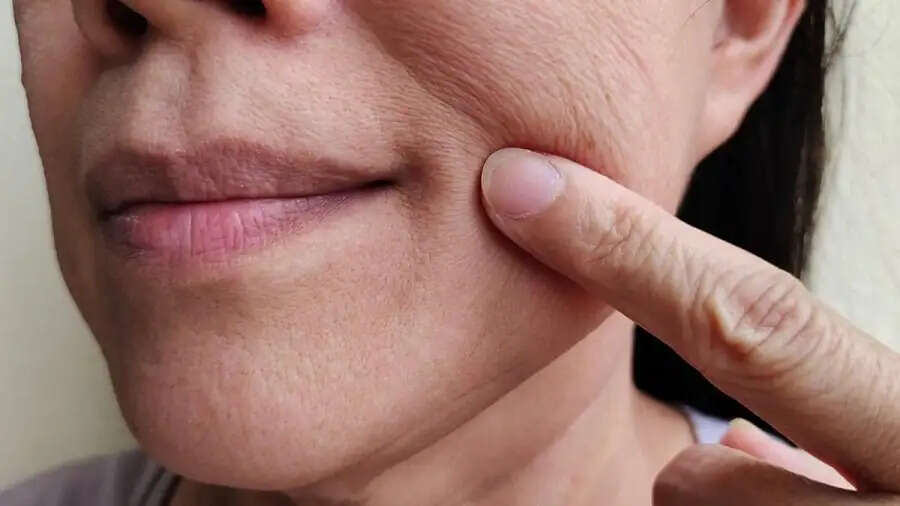 Skin Care Tips-&nbsp;क्या आप चेहरे कि स्कीन को टाइट और चमकदार बनाना चाहते हैं,&nbsp;जानिए इसका तरीका