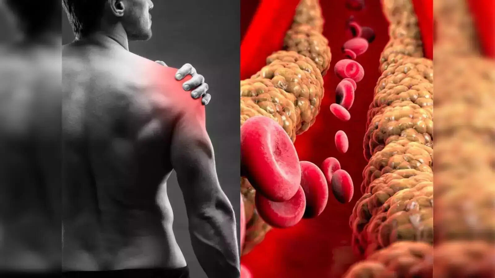 Health Tips- क्या आपके शरीर में बढ़ गया बैड कोलेस्ट्रॉल, इसे कम करने के लिए अपनाएं ये आदतें