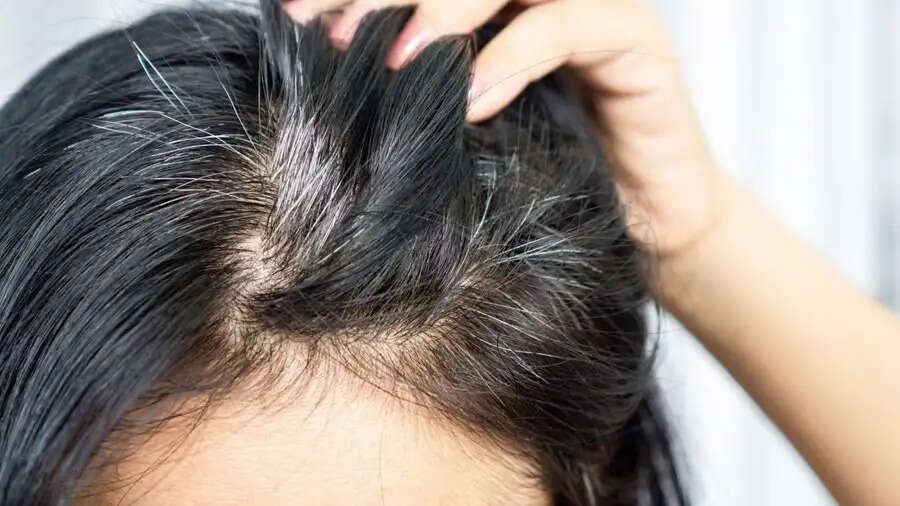 Hair Care Tips-&nbsp;क्या उम्र से पहले बाल होने लगे हैं सफेद, तो शरीर में इस विटामिन की हो गई हैं कमी