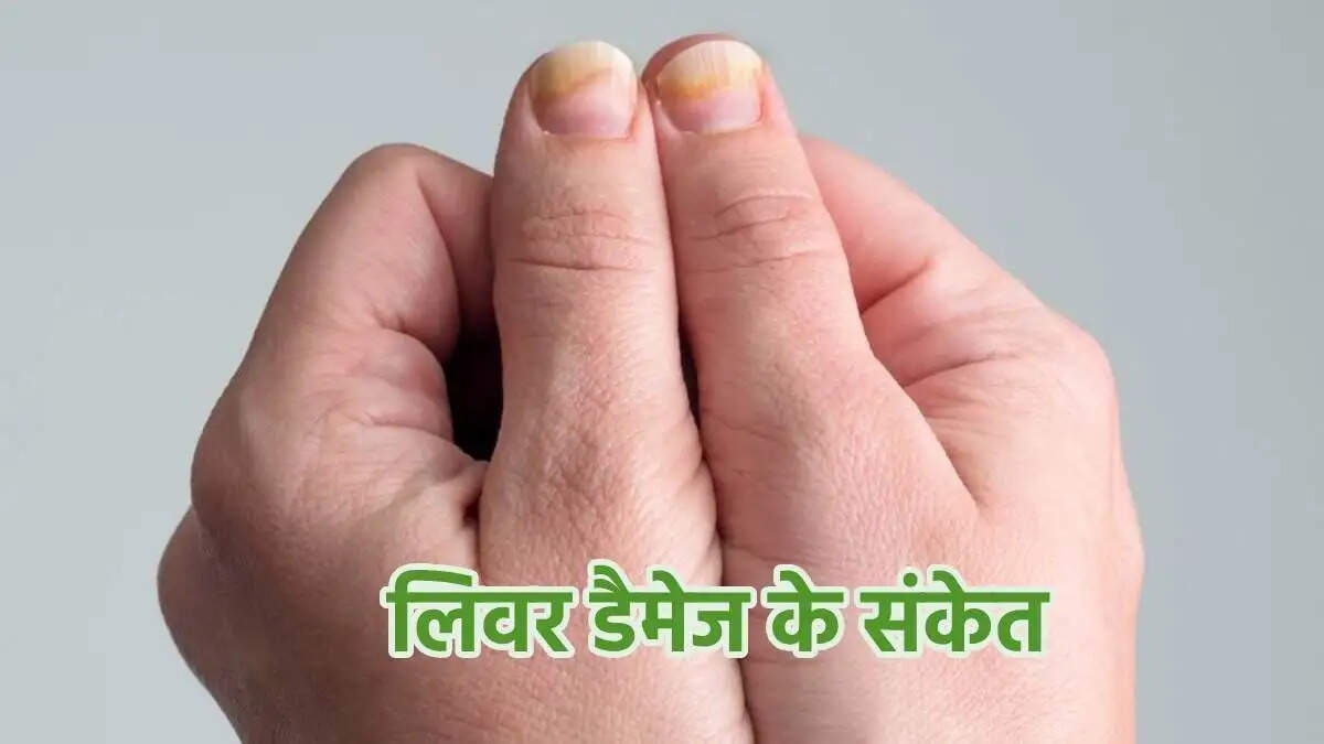Health Tips- क्या आपके हाथ पैर के नाखूनों में अचानक हो रहे हैं बदलाव, तो हो सकती हैं लिवर से जुड़ी बीमारी