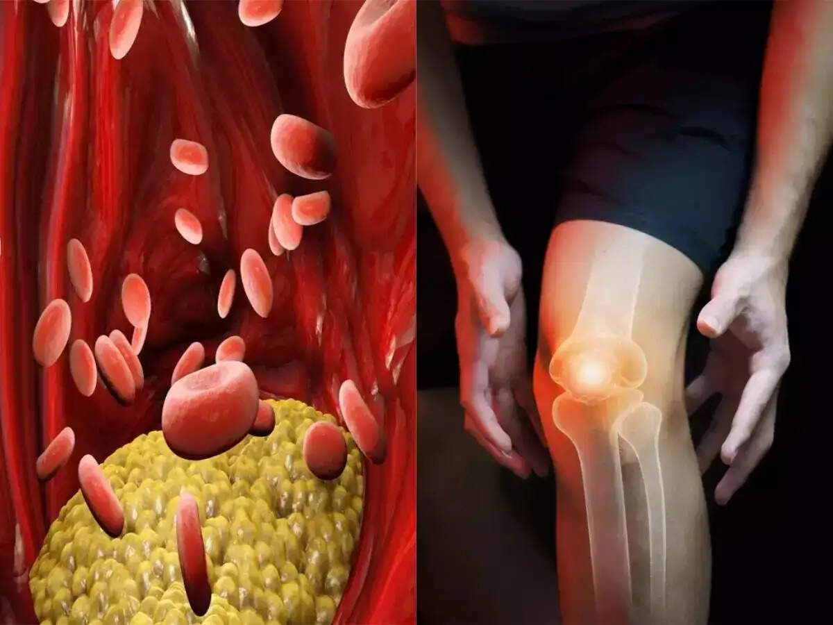 Health Tips- &nbsp;हाई कोलेस्ट्रॉल के इशारे केवल दिल ही नहीं देता हैं, इन बॉड़ी पार्टस का भी समझे इशारा