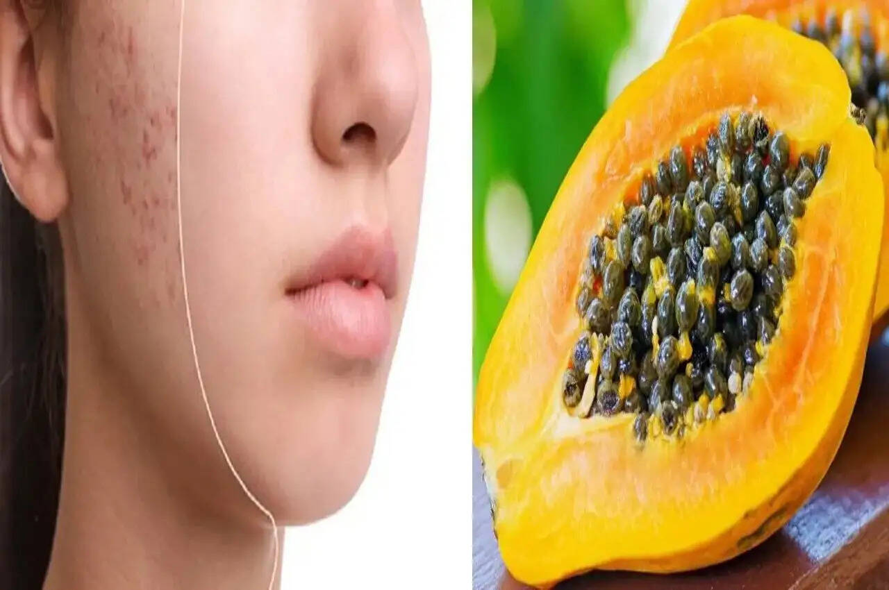 Health Tips- &nbsp;क्या आप भी पपीता खा कर बीज फेंक देते हैं, जानिए बीज के फायदें, जान लेंगे तो फिर नहीं करेंगे यह हरकत