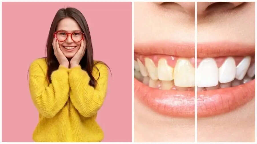 Teeth Care Tips-&nbsp;क्या पीले दातों से परेशान है, सफेद पाने के लिए इस चीज का करें इस्तेमाल