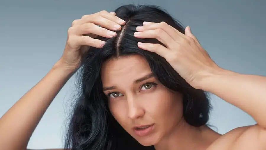 Hair Care Tips- क्या रूसी की वजह से बालों में खुजली हो गई हैं, तो ऐसे पाएं छुटकारा