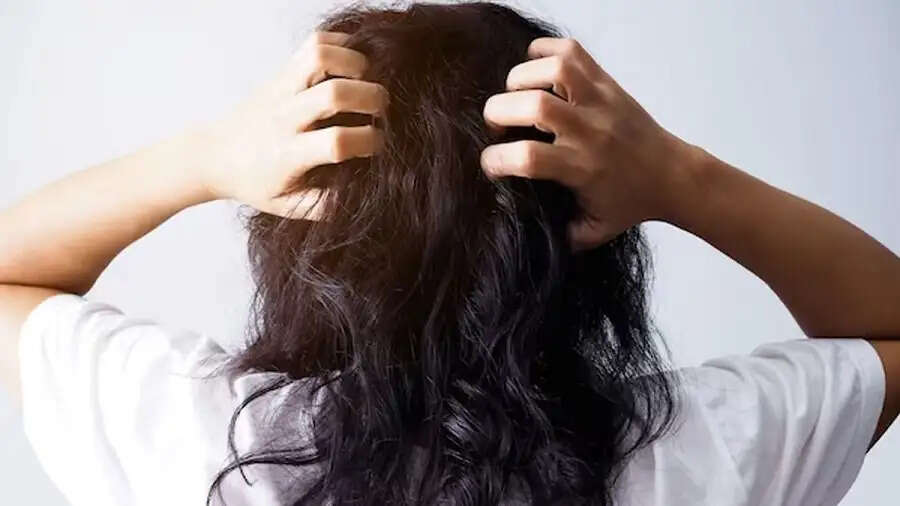 Hair Care Tips-&nbsp;क्या गर्मी के कारण सिर में चलती हैं खुजली, छुटकारा पाने के लिए अपनाएं ये टिप्स