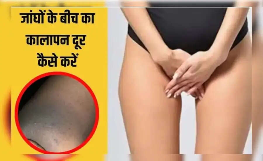 Skin Care Tips-&nbsp;क्या आप प्राइवेट पार्ट के कालेपन से परेशान हैं,&nbsp;&nbsp;ऐसे करें इन्हें साफ