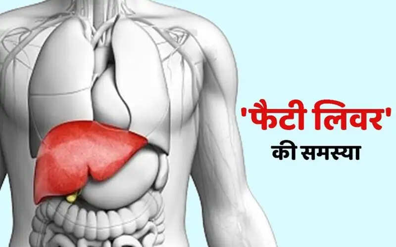 Health Tips- क्या आप फैटी लिवर से परेशान हैं, जानिए इसके शुरुआती लक्षण और उपाय