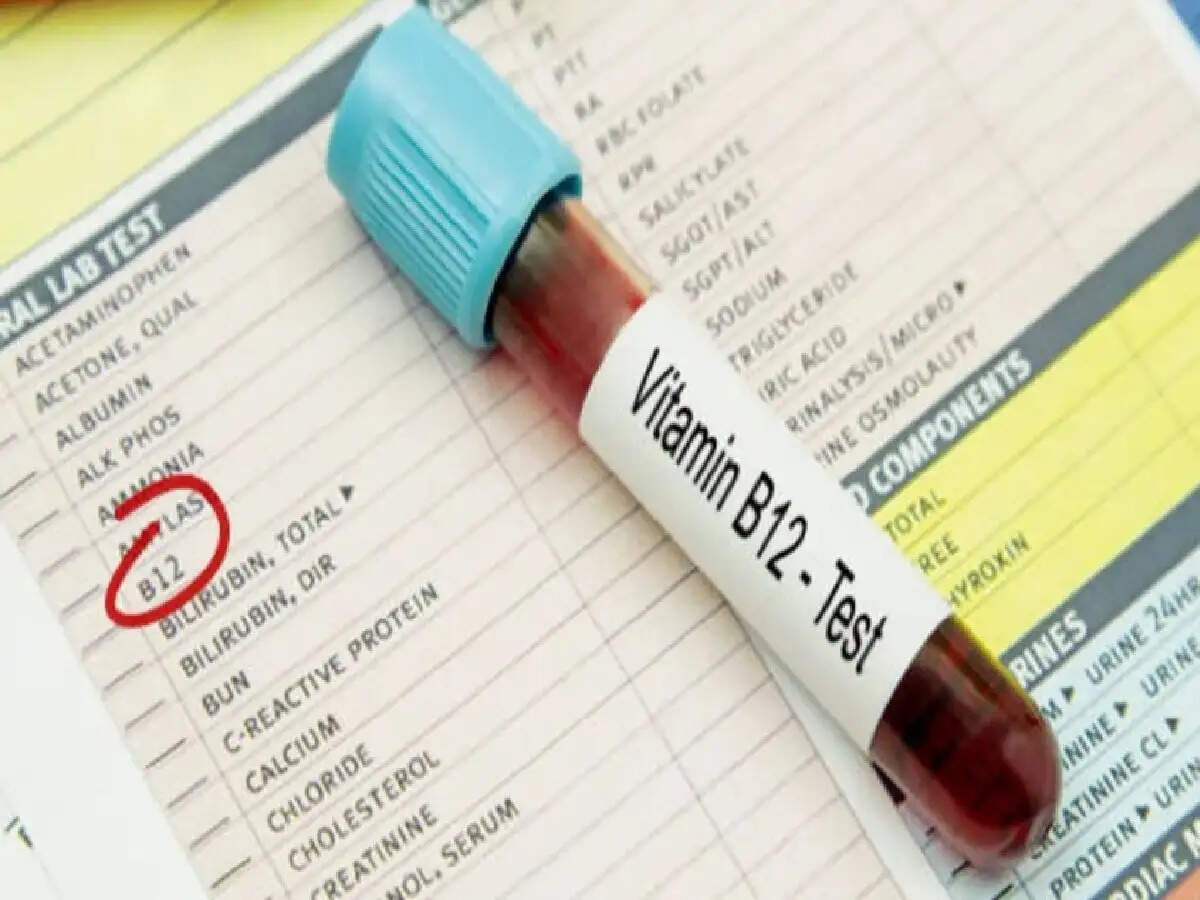 Vitamin B12 की कमी से हड्डियां हो सकती हैं कमज़ोर! अगर शरीर में ये लक्षण दिखने लगें, तो अपनी डाइट में ये चीजें करें शामिल