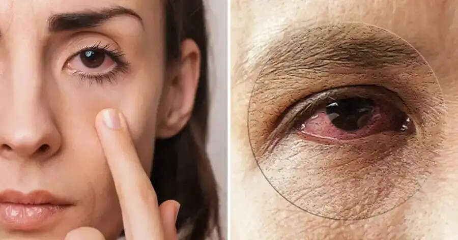 Eye Care Tips- आंखों में दिखें ये लक्षण, तो तुरंत कराएं ये इलाज