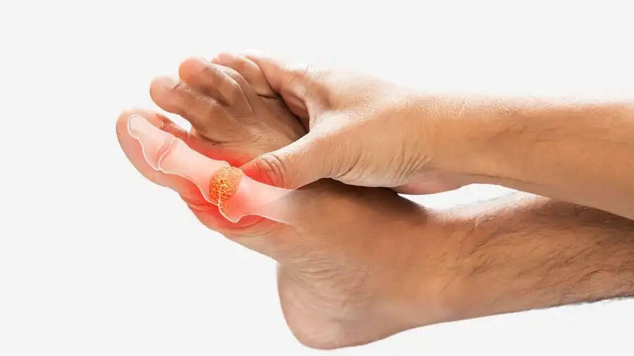 Health Tips- इन चीजों के सेवन से बढ़ जाता हैं यूरिक एसिड, जानिए इनके बारे में