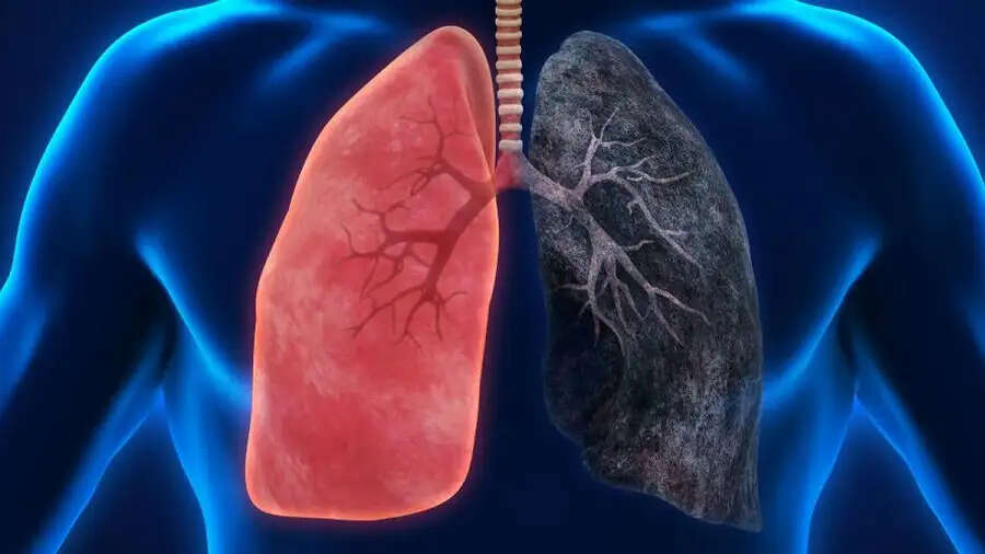 Health Tips- लंग कैंसर होने पर दिखाई देते हैं ये लक्षण, नजरअंदाज करने से हो सकता हैं नुकसान