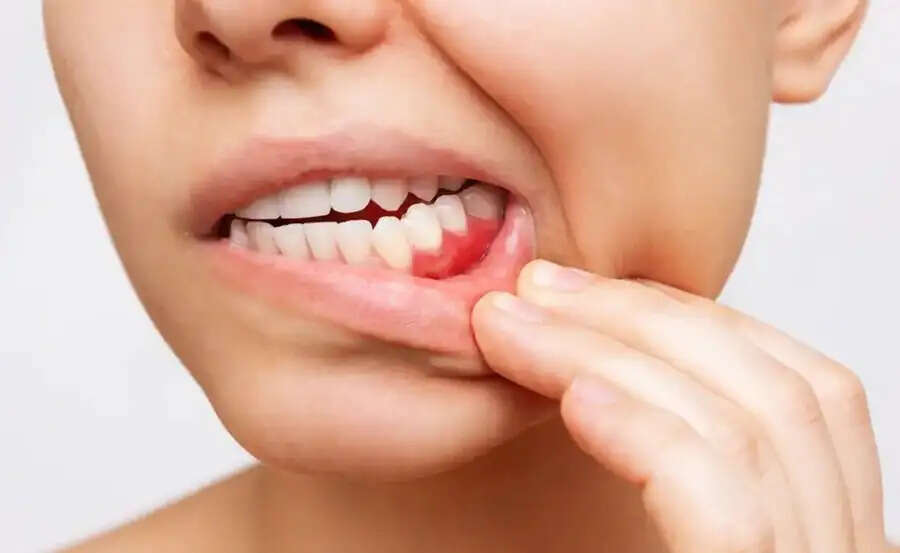 Teeth Care Tips-&nbsp;ब्रश करने के बाद इन चीजों का सेवन हो सकता हैं नुकसानदायक, जानिए इनके बारे में