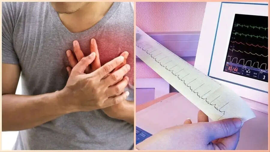Health Tips- ECG कब किया जाता हैं, आइए जानें पूरी डिटेल्स