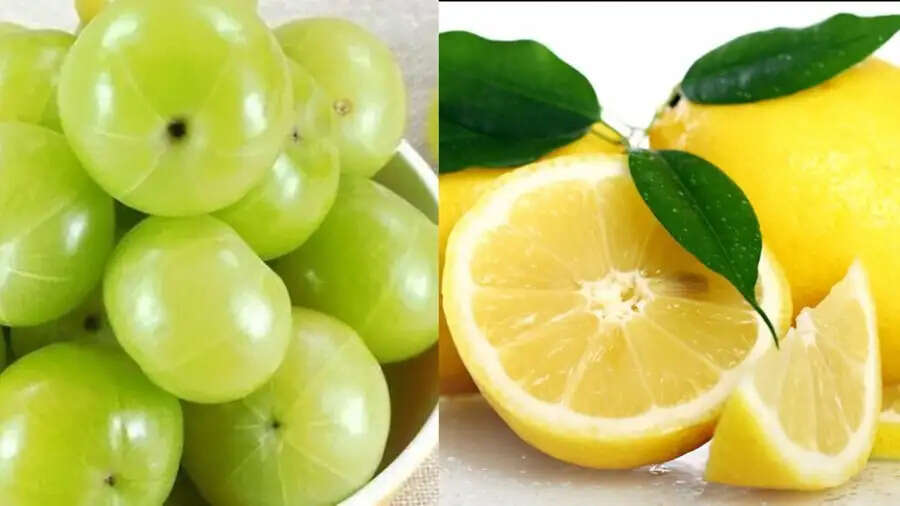 Health Tips-&nbsp;आंवला&nbsp;या नींबू किसमें होता हैं ज्यादा विटामिन सी, आइए जानते हैं पूरी डिटेल्स