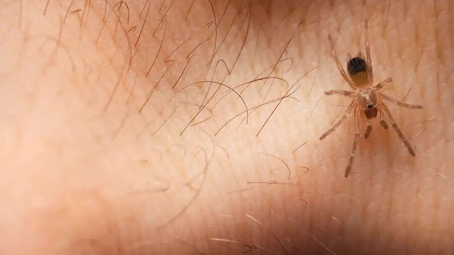Spider Bite Tips-&nbsp;क्या आपको मकड़ी ने काट लिया है, तो जानिए इसके घरेलू उपाय
