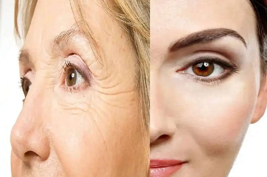 Skin Care Tips-&nbsp;क्या आप भी अपनी स्किन को रखना चाहते हैं टाइट, जानिए कैसे रहेगी यह
