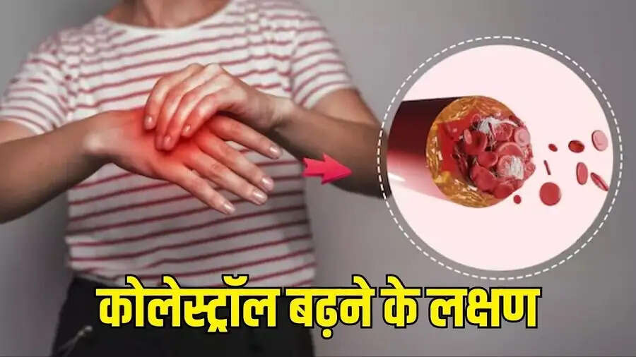 Health Tips-&nbsp;शरीर में कोलेस्ट्रॉल बढ़ने पर दिखाई देते हैं लक्षण, जानिए इनके बारे में