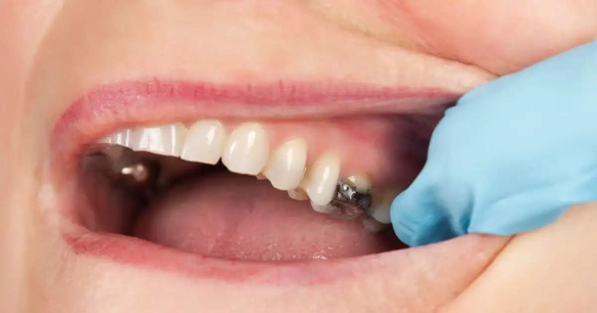 Teeth Care Tips- दातों की सफाई ना रखने से दांत केवल सड़ते नहीं हैं, हो सकता हैं कैंसर, भूलकर भी इन इशारों को ना करें इग्नौर
