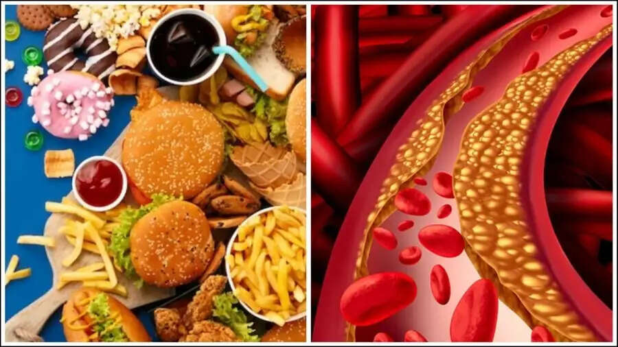 Health Tips –&nbsp;इन चीजों के सेवन से शरीर में बढ़ जाता हैं बैड कोलेस्ट्रॉल, आज ही बना लें इनसे दूरी