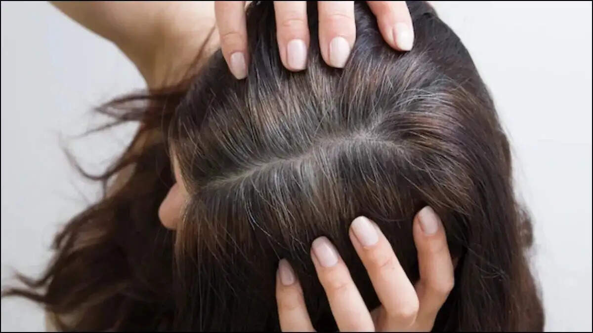 Hair Care Tips- &nbsp;क्या आपके बाल नहीं बढ़ रहे हैं, तो लगा लें यह कैप्सूल